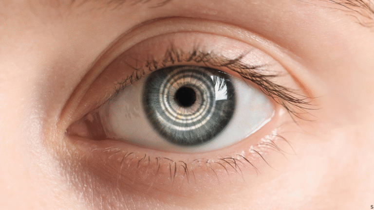 hypnosis for stress management